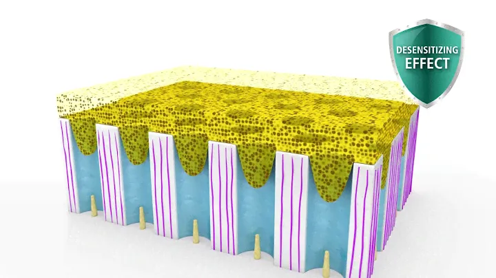 Ivoclar Vivadent Tetric N-Bond Universal - How does it work? | pinkblue